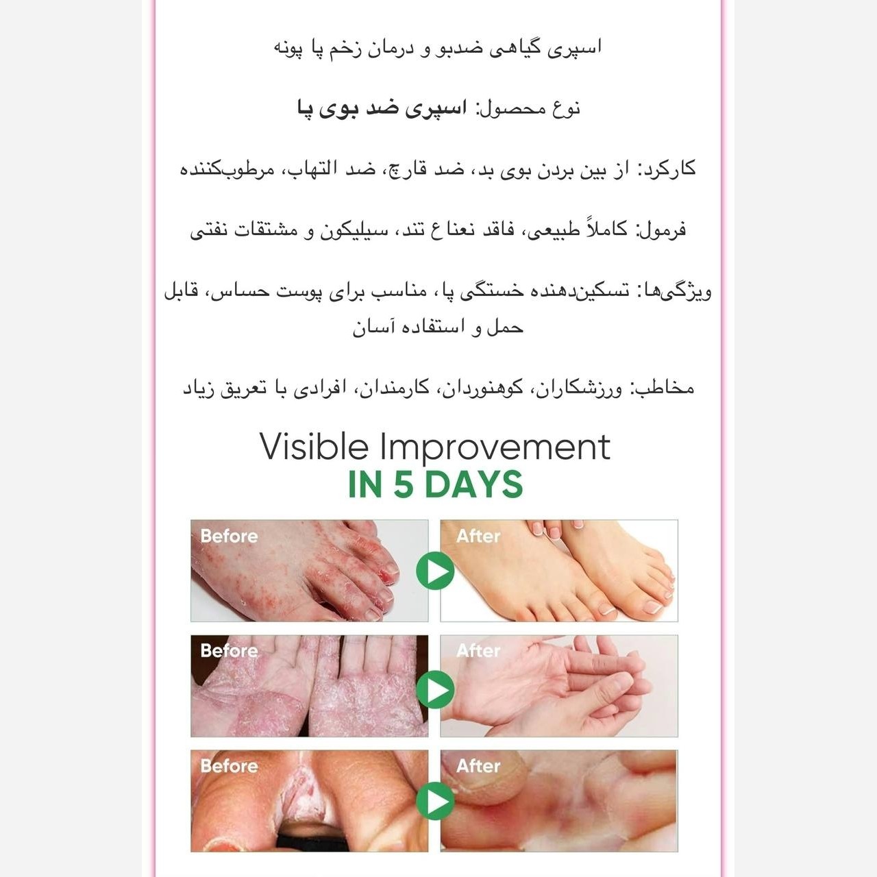 اسپری پا گیاهی