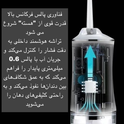 واتر جت شستشوی دهان و دندان