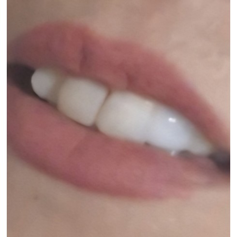 لمینت پودری ترواسمایل هدیه نوار چسب سفید کننده دندان 100درصد ارجینال