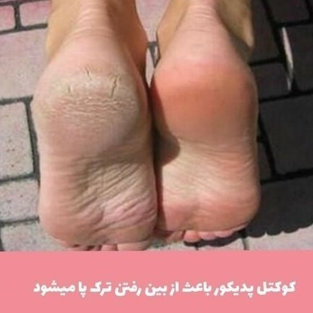 پدیکور پک 3عدد کوکتل و یک عدد سوهان(قیمت مناسب،عرضه مستقیم)