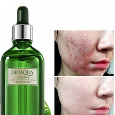 سرم چای سبز(ضدچین ،چروک و لیفت) بیواکوا(قیمت مناسب،عرضه مستقیم)